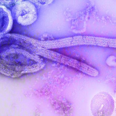Śmiercionośny wirus Ebola i jego historia #badania #komórki #naukowcy #organizmy #wirusy #życie - ciekawostki.app